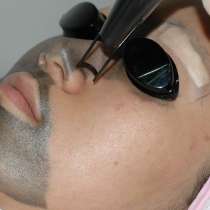 гель для карбонового пилинга, в Москве