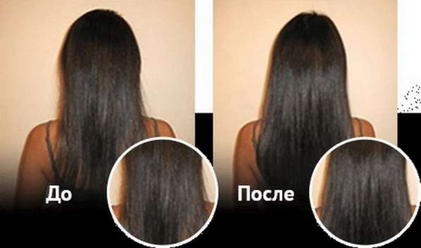 Спрей для восстановления и роста волос Ultra Hair Spray Syst в Москве фото 11