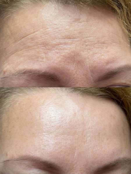 Косметолог эстет в Грозном фото 3