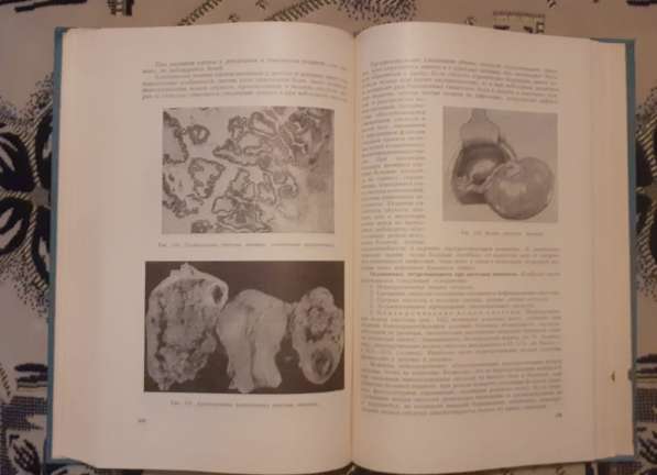 Книга Бодяжина Жмакин Гинекология Медицина 1967 учебник ссср в фото 4