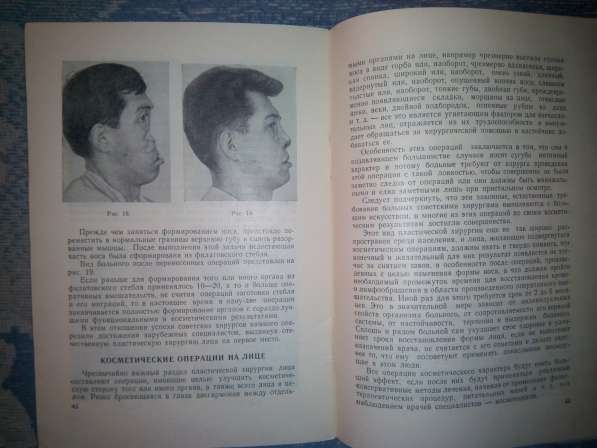 Пластические операции на лице 1953г в Чите фото 4
