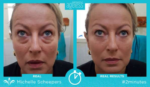 Instantly Ageless микро-крем против "мешков" под глазами!