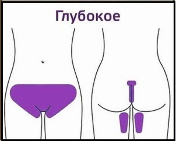 Предлагаю шугаринг Глубокое бикини в Нижнем Новгороде
