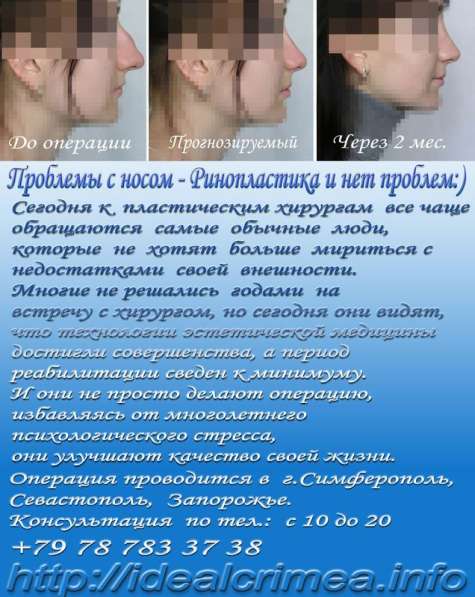 Эстетическая медицина и косметология Крым, Симферополь в Симферополе фото 7